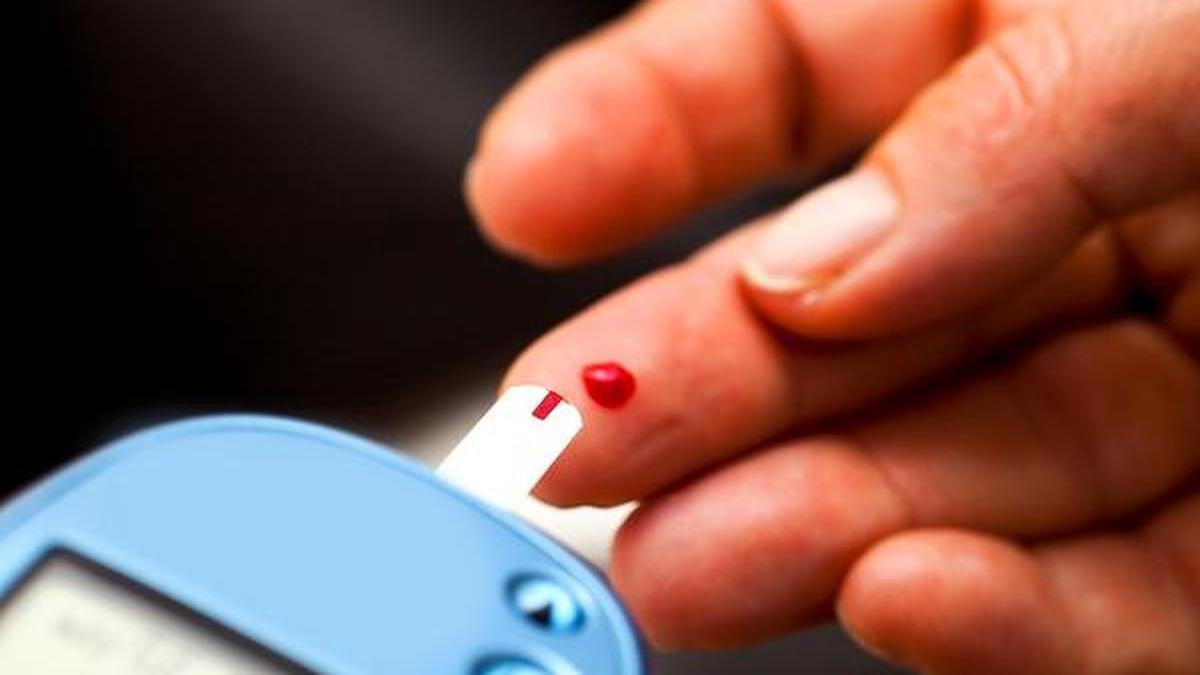 تصویر 1 از دستگاه قند خون آزمایشگاهی کالیبره شده و اتوماتیک با دقت بالا